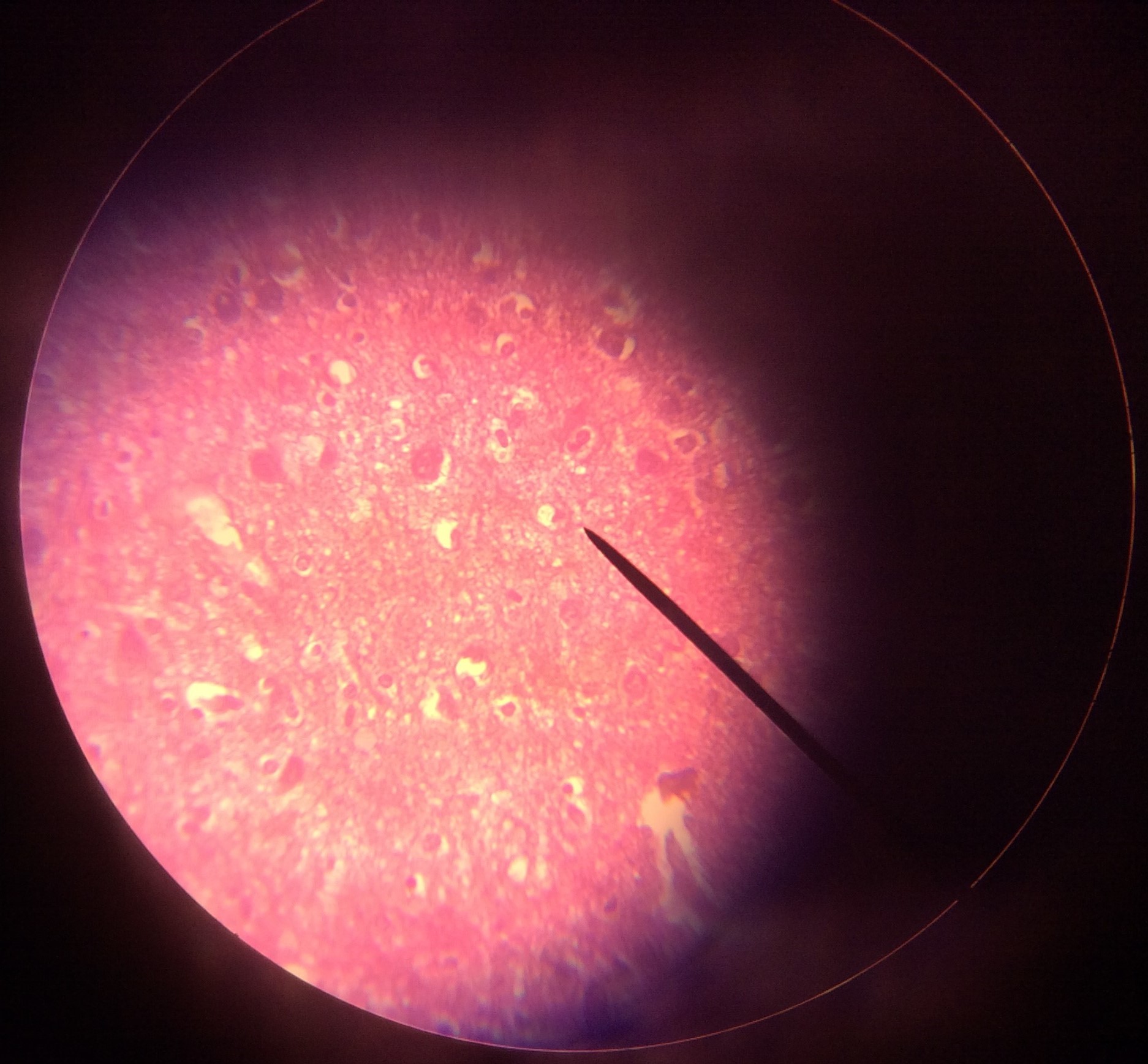 Human bone marrow